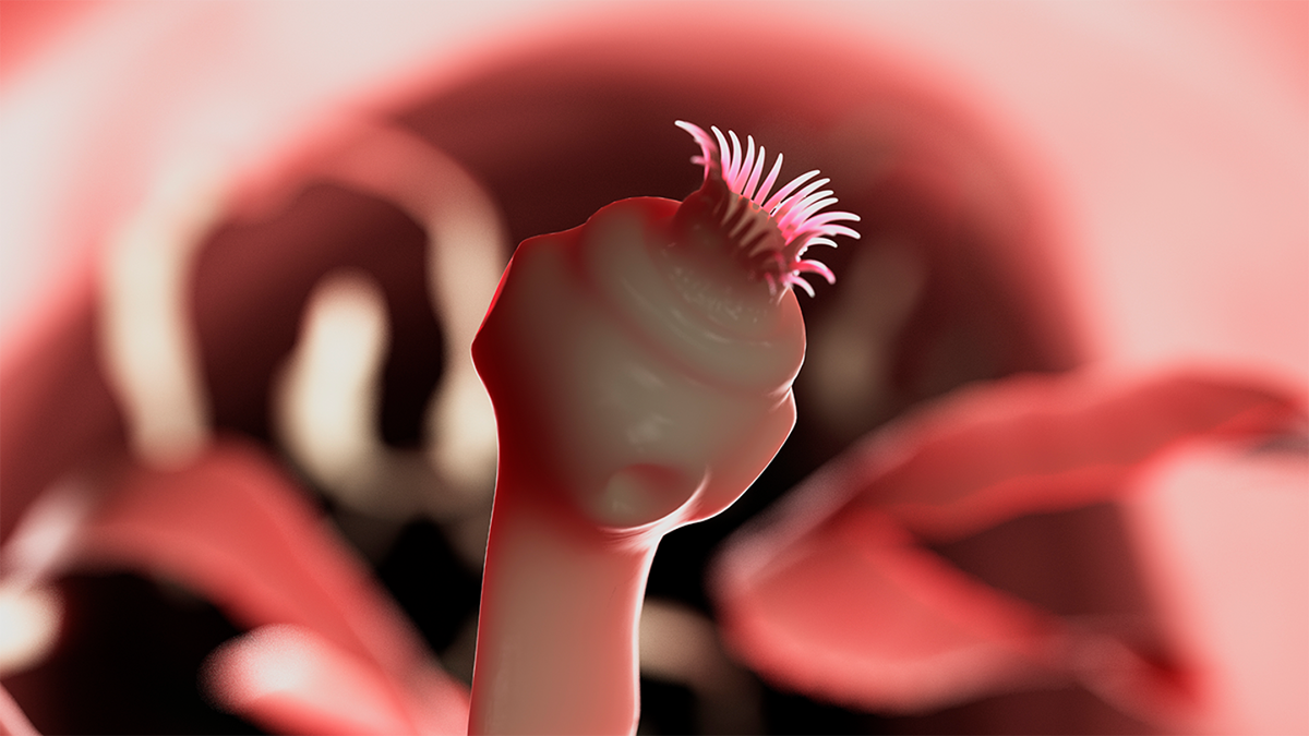 Horrifying thing that happened to woman's brain after eating tapeworm eggs she bought on the dark web