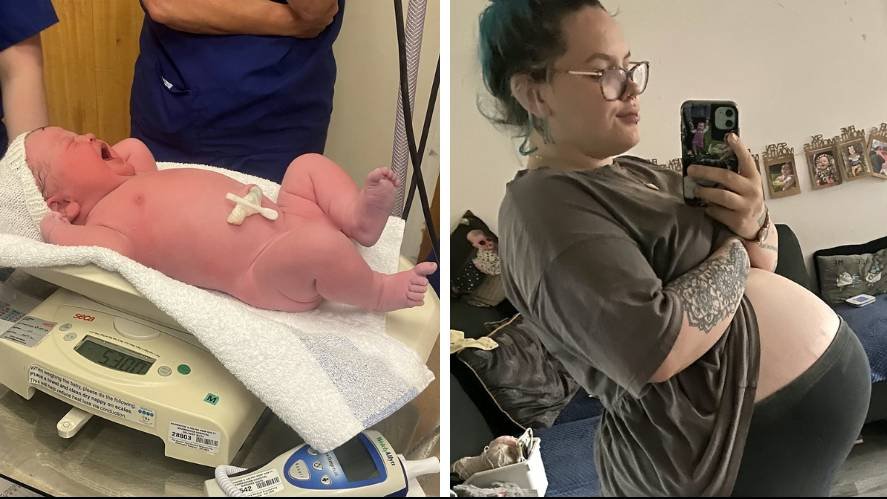 Doctors gasped as mum gave birth to baby the 'size of a toddler' with head 'as big as a melon' | Flipboard