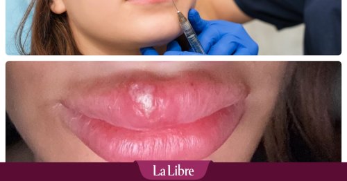Un "faux chirurgien esthétique" épinglé par une Belge de 18 ans suite à des complications: "Je suis inscrit à l'Ordre des médecins en Roumanie"