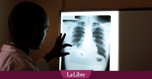 Faire des économies au prix de vies humaines : le scandale silencieux de la tuberculose