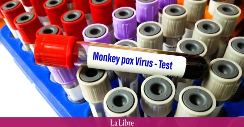 "Elle n’est pas liée aux personnes homosexuelles": une infectiologue donne des précisions sur la variole du singe