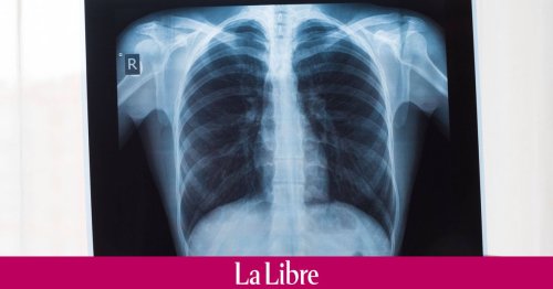 "Une réelle avancée dans l’arsenal thérapeutique” : ce qu’il faut savoir sur le nouveau traitement contre le cancer du poumon