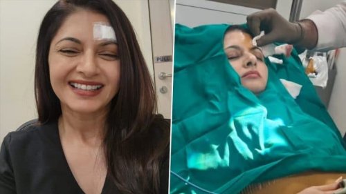Bhagyashree Suffers Deep Forehead Injury While Playing Pickleball, Undergoes Surgery and Gets 13 Stitches (See Pics)
