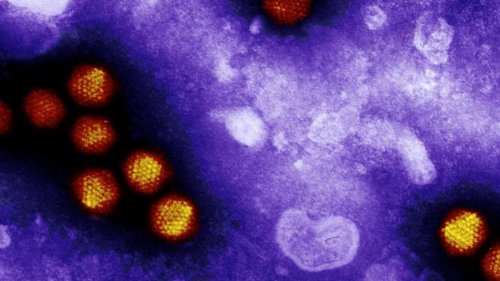 España notifica 9 casos más de hepatitis infantil de origen desconocido
