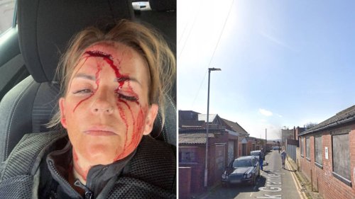 Female police officer suffers horrific gash to face after being rammed by suspected drug dealer