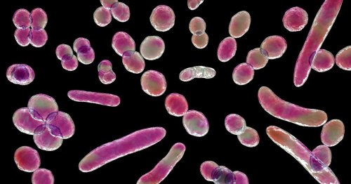 Leicestershire Sees 22 Scarlet Fever Infections In Just One Week As 