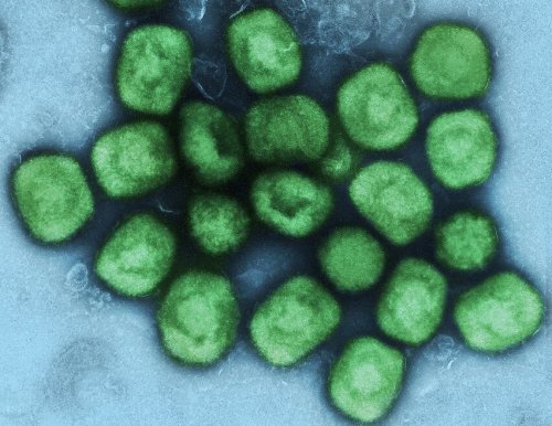 Des chercheurs italiens isolent le virus monkeypox dans le sperme d’un patient présentant une excrétion virale prolongée