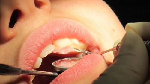 Trappes : après un détartrage chez le dentiste, il découvre une facture de 8 000 euros