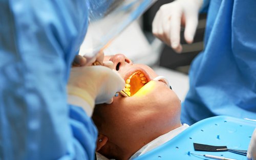 Les soins dentaires coûtent désormais plus cher aux Français