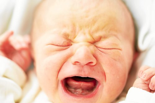 Le frein de la langue du nourrisson : un frein à l’allaitement ?
