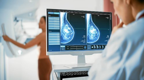 Cancer du sein : la participation au dépistage organisé continue de baisser en France