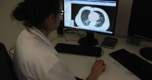 Cancer du poumon : "la nouvelle arme thérapeutique" d'AstraZeneca qui pourrait sauver des vies