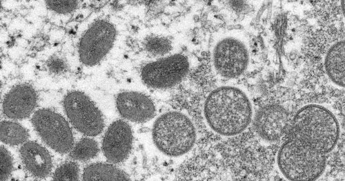 Qu’est-ce que la variole du singe, ce virus qui se propage en Europe et en Amérique ?