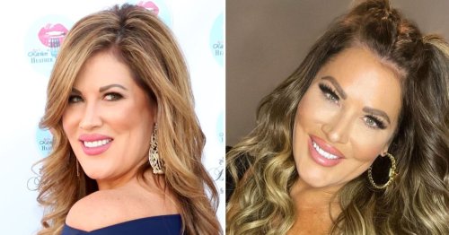 Did RHOC’s Emily Simpson Get Plastic Surgery? Facelift Announcement ...