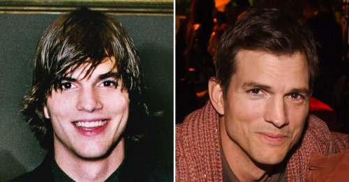 Did Ashton Kutcher Get Plastic Surgery? Inside Rumors, His Quotes