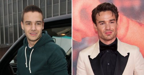 Did Liam Payne Get Plastic Surgery? Fans Claim Buccal Fat Removal ...