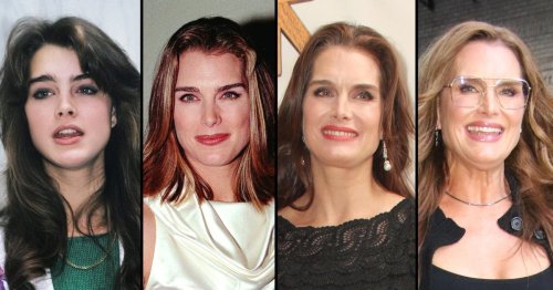 Has Brooke Shields Had Plastic Surgery Transformation Photos Flipboard