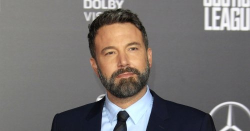 Has Ben Affleck Had Work Done? Plastic Surgery Rumors, Explained ...