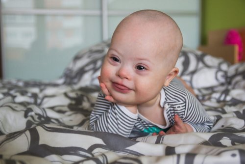 95% of babies with Down syndrome in Ireland are aborted: report - LifeSite
