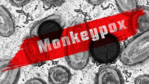 Variole du singe : l'épidémie continue de progresser avec 2171 cas déclarés en France ce mardi