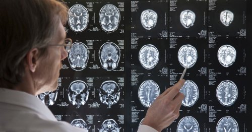 The popular drink said to hugely increase your risk of dementia
