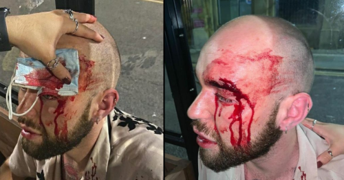 Two arrested after appalling homophobic attack that has shocked city