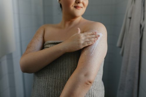 What Causes Keratosis Pilaris and How Is It Treated?