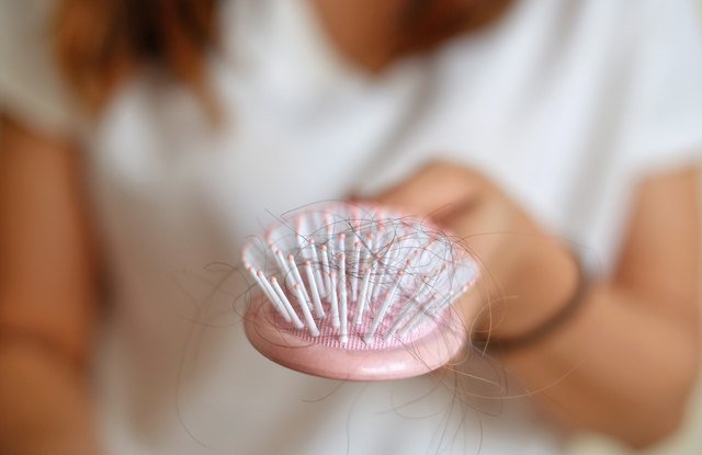 How Much Daily Hair Loss Is Normal?