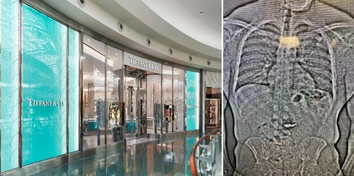 Florida man gives a new meaning to wearing luxury by gulping down $770,000 worth of diamond earrings in a Tiffany showroom to outsmart cops