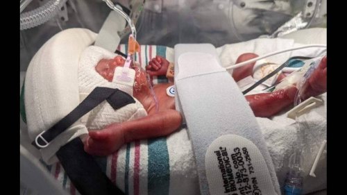 Best friend delivers woman's 24-week-old baby on side of highway, Georgia officials say