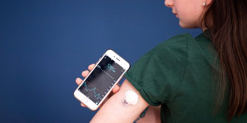 Zulassungsbehörde warnt vor Smartwatches mit Blutzuckermessung