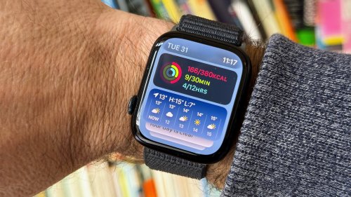 Apple Watch X: Diese neuen Features können Sie erwarten
