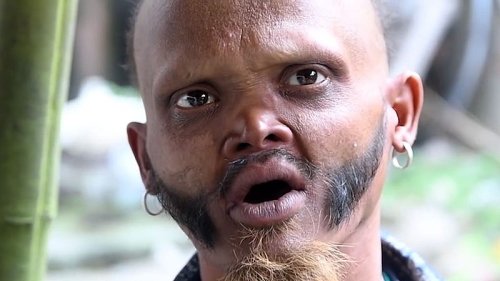 Mann, der seine eigene Stirn lecken kann, behauptet die längste Zunge der Welt zu haben
