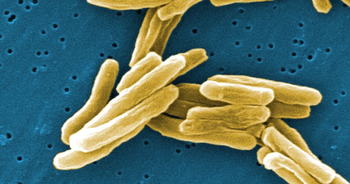 The ‘Victorian disease’ making a comeback in the UK that expert says is ‘a ticking time bomb’