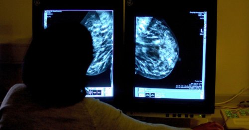 Simple changes can cut cancer cases, new study shows
