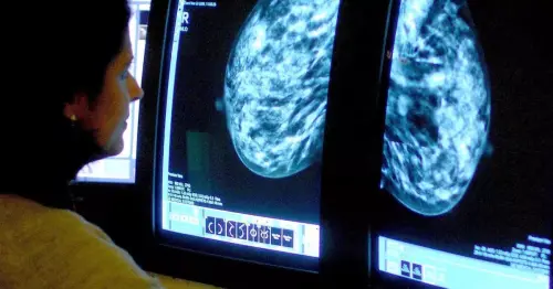 'Giant step' Researchers discover health supplement drug that can halt the recurrence and spread of breast cancer