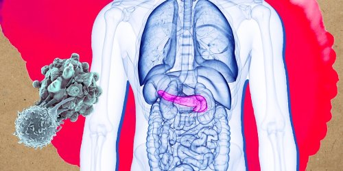 Cancer du pancréas : une piste prometteuse pour l'identifier beaucoup plus tôt