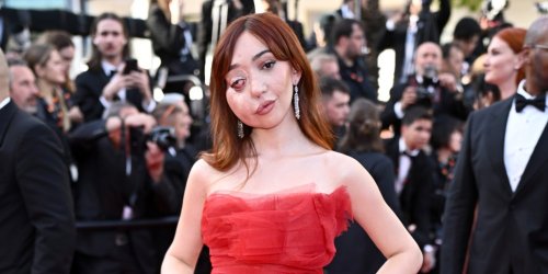 Qui est Nikki Lilly, militante britannique atteinte d’une maladie rare, qui a monté les marches du Festival de Cannes 2025 ?