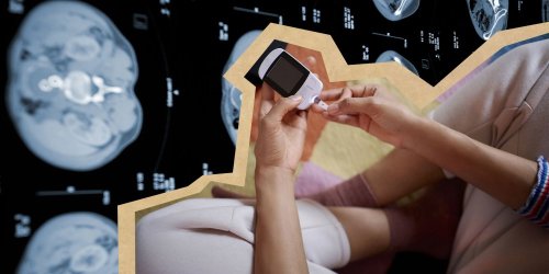 Cancer du pancréas : ces deux signes avant-coureurs de la maladie à surveiller