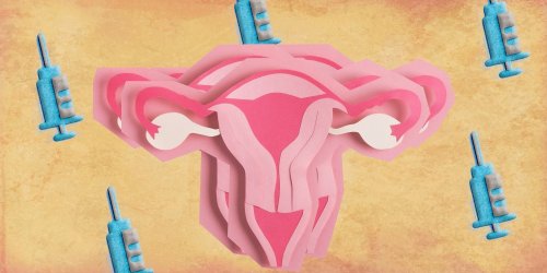 Cancer du col de l'utérus : après une chirurgie des lésions, le vaccin contre le papillomavirus réduirait le risque de récidive