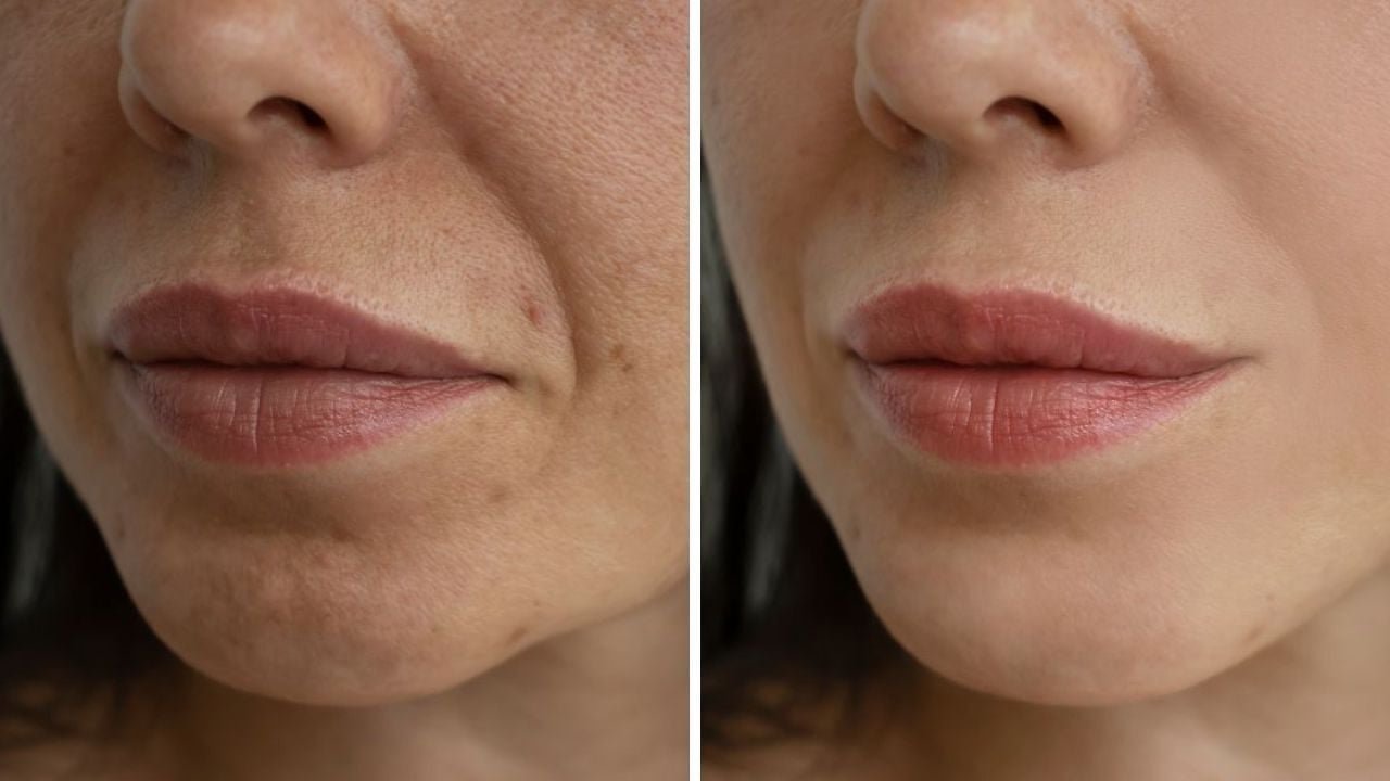 Adieu les rides, ce sérum 'renovateur de jeunesse' donne 10 ans de moins à la peau, selon les résultats cliniques