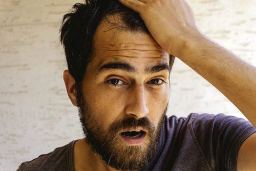 Calvitie : 6 astuces imbattables pour combattre la perte de cheveux