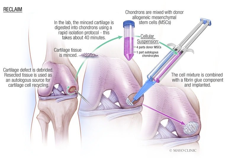 Bone and skeletal care - cover