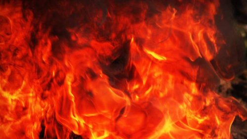 Man suffered severe burns at a Salem park