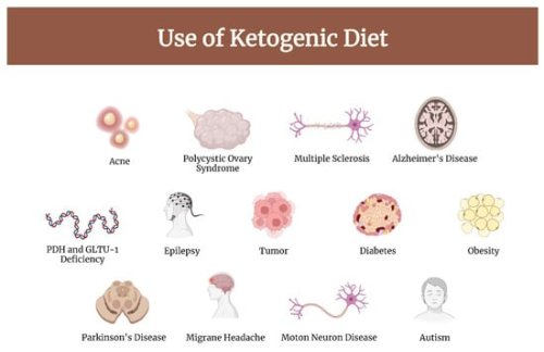 Ketogenic Diet in the Treatment of Gliomas and Glioblastomas