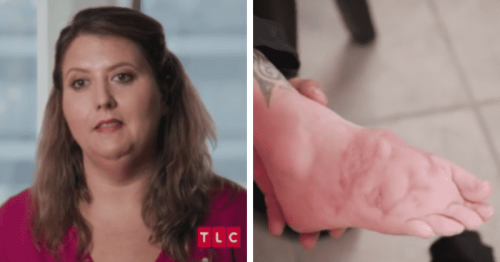 What Happened To Alisha Williams Feet A Look At My Feet Are Killing Me Star S Accident Flipboard