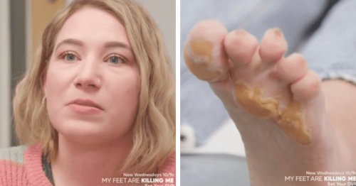 My Feet Are Killing Me What Is Olmsted Syndrome Dr Sarah Haller Deals With A Rare Case Flipboard