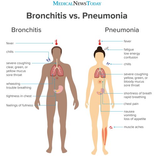 Is it bronchitis or pneumonia?