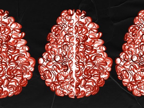 COVID 19 s Impact On The Brain Immune Response May Cause Damage 
