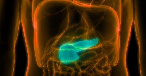 Pancreatic cancer: Modified flu virus destroys tumors